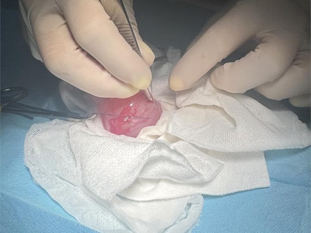 Cistotomía para extracción de urolitos