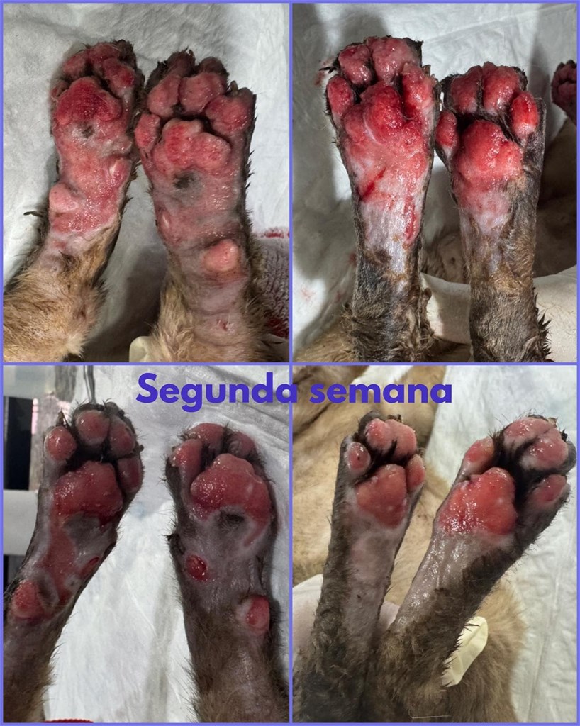 Recuperación de quemaduras
