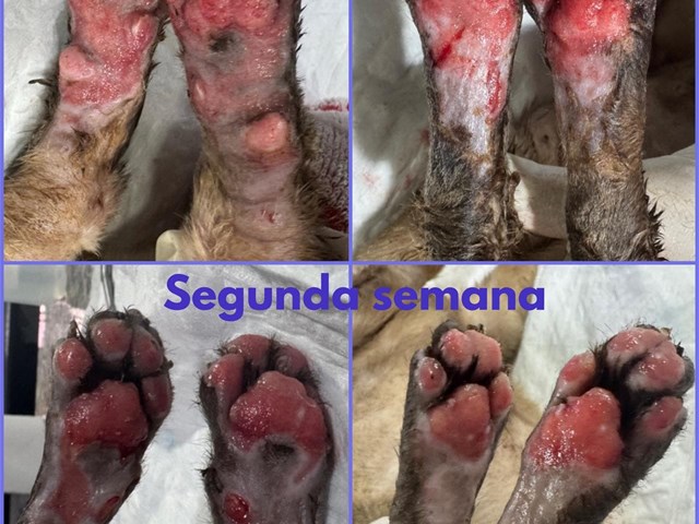 Recuperación de quemaduras